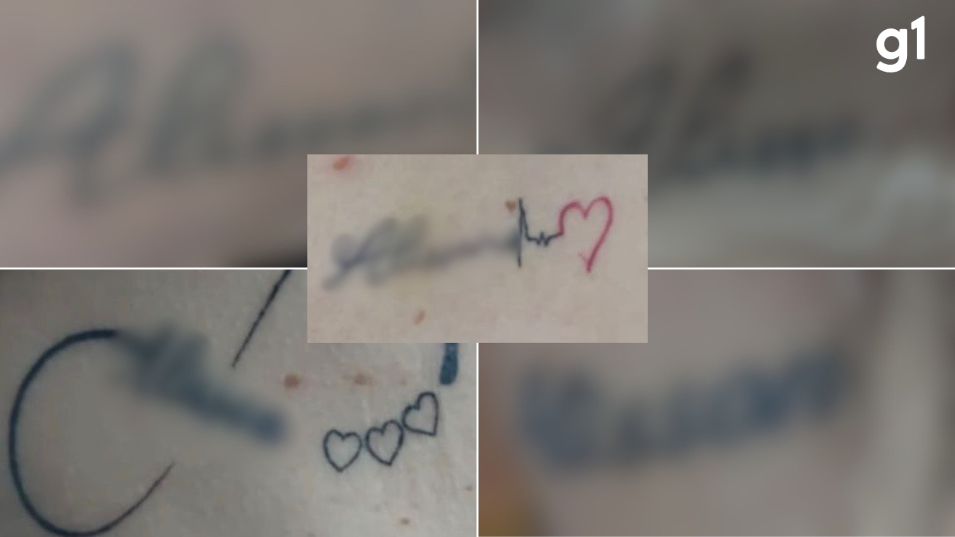 Mulher foi obrigada a fazer 9 tatuagens  com nome de dentista no mesmo dia, diz polícia