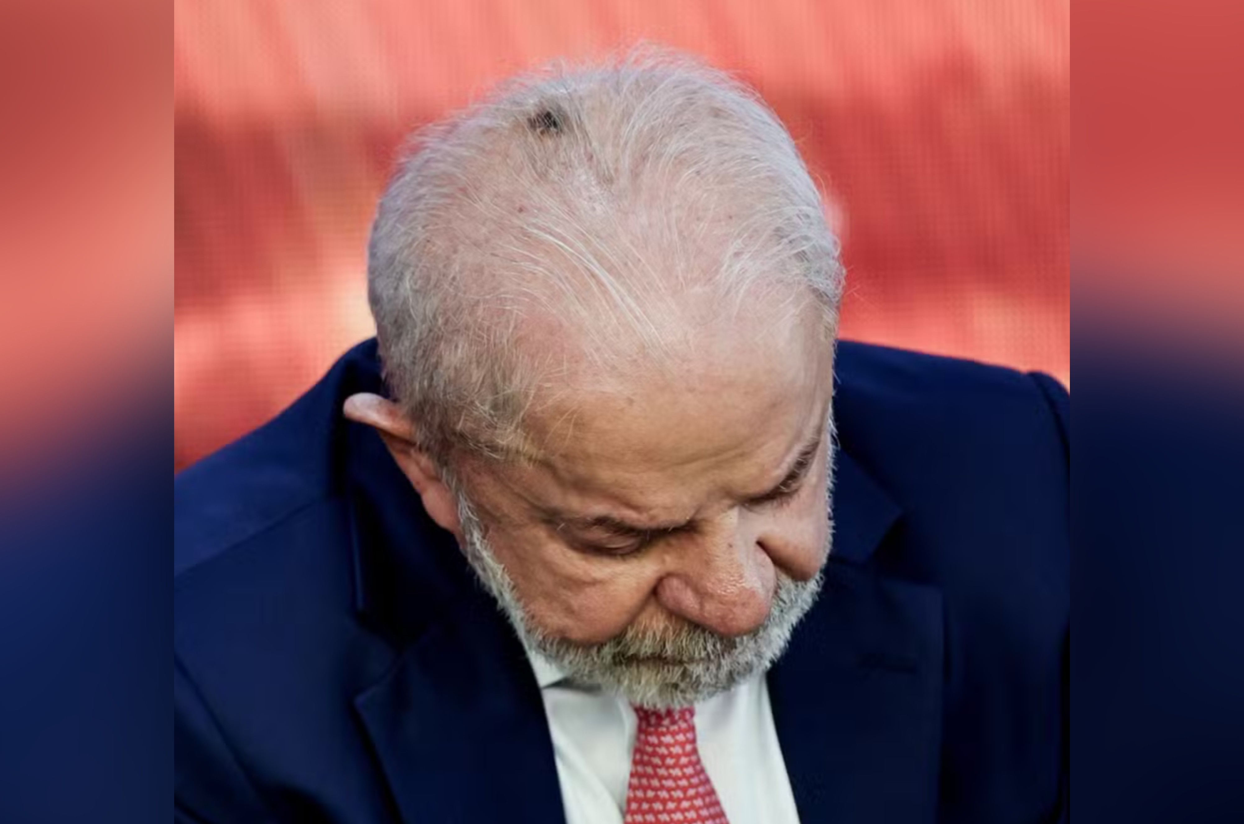 Lula fará retirada de acúmulo de pele na cabeça e infiltração no punho para tratar tendinite, diz Planalto