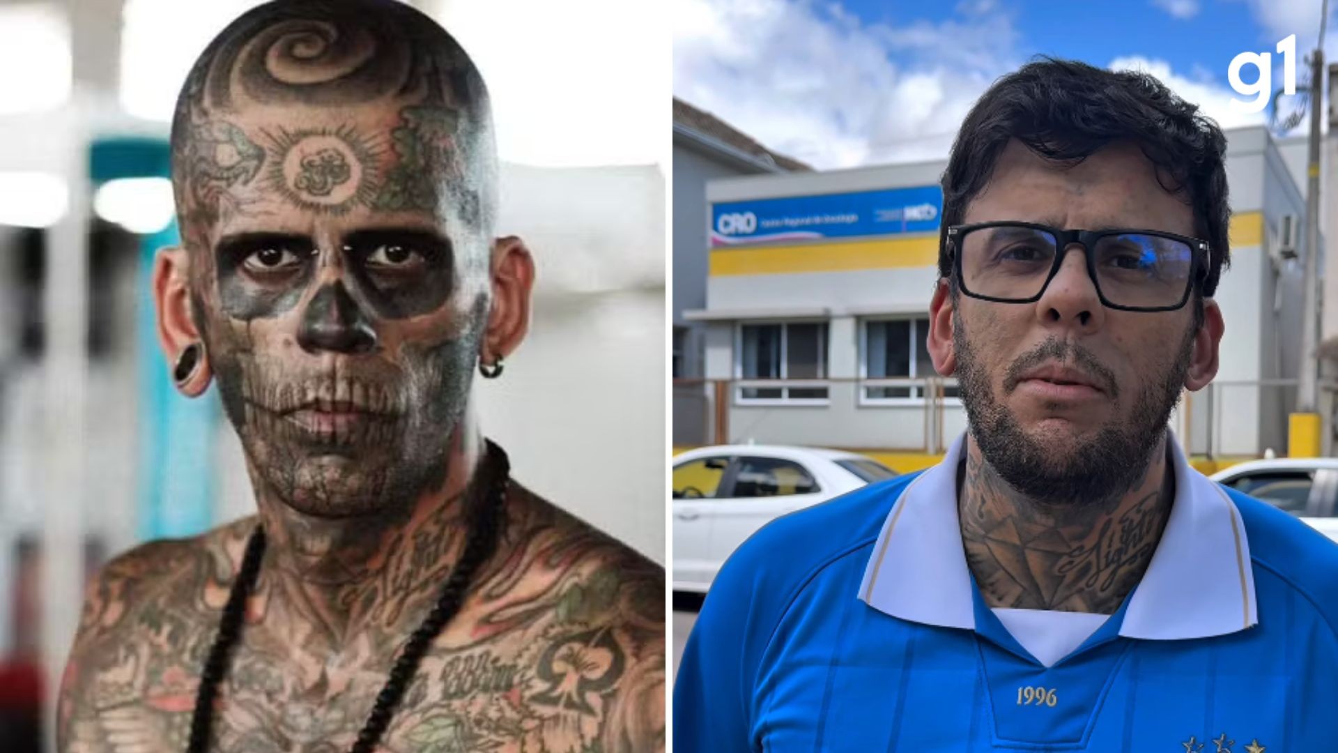 'Mais tatuado do Brasil' detalha tratamento contra câncer após 1ª sessão de quimioterapia