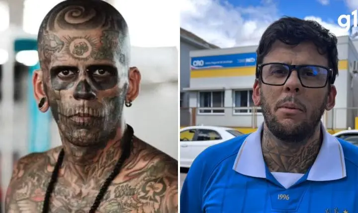 'Mais tatuado do Brasil' detalha tratamento contra câncer após 1ª sessão de quimioterapia